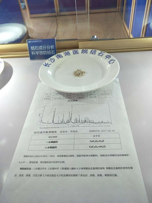 膽結(jié)石疼的厲害怎么辦？